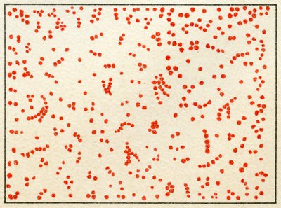 Sample of Micrococcus Bacteria by German School